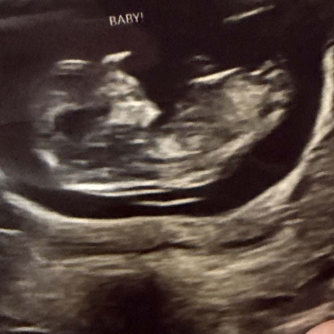 Photo shared by Emilia for their Babylist baby registry.