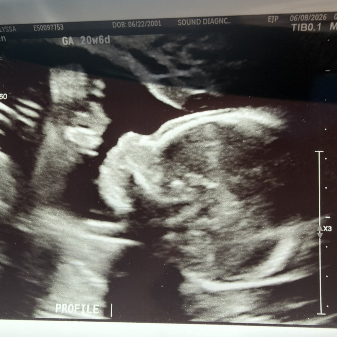 Photo shared by Alyssa for their Babylist baby registry.