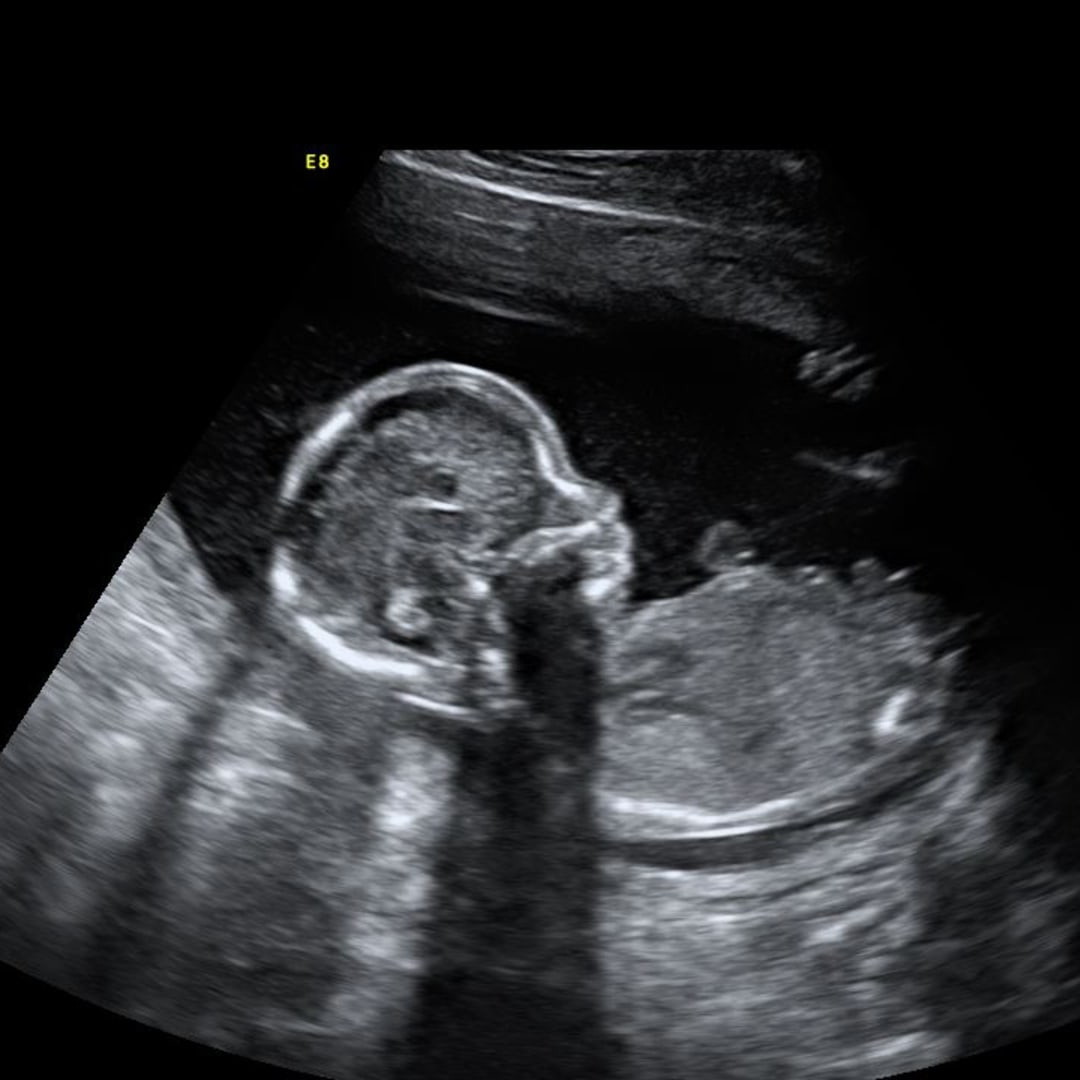 Photo shared by Madeline for their Babylist baby registry.