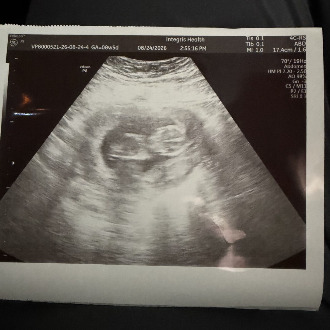Photo shared by Zoe for their Babylist baby registry.