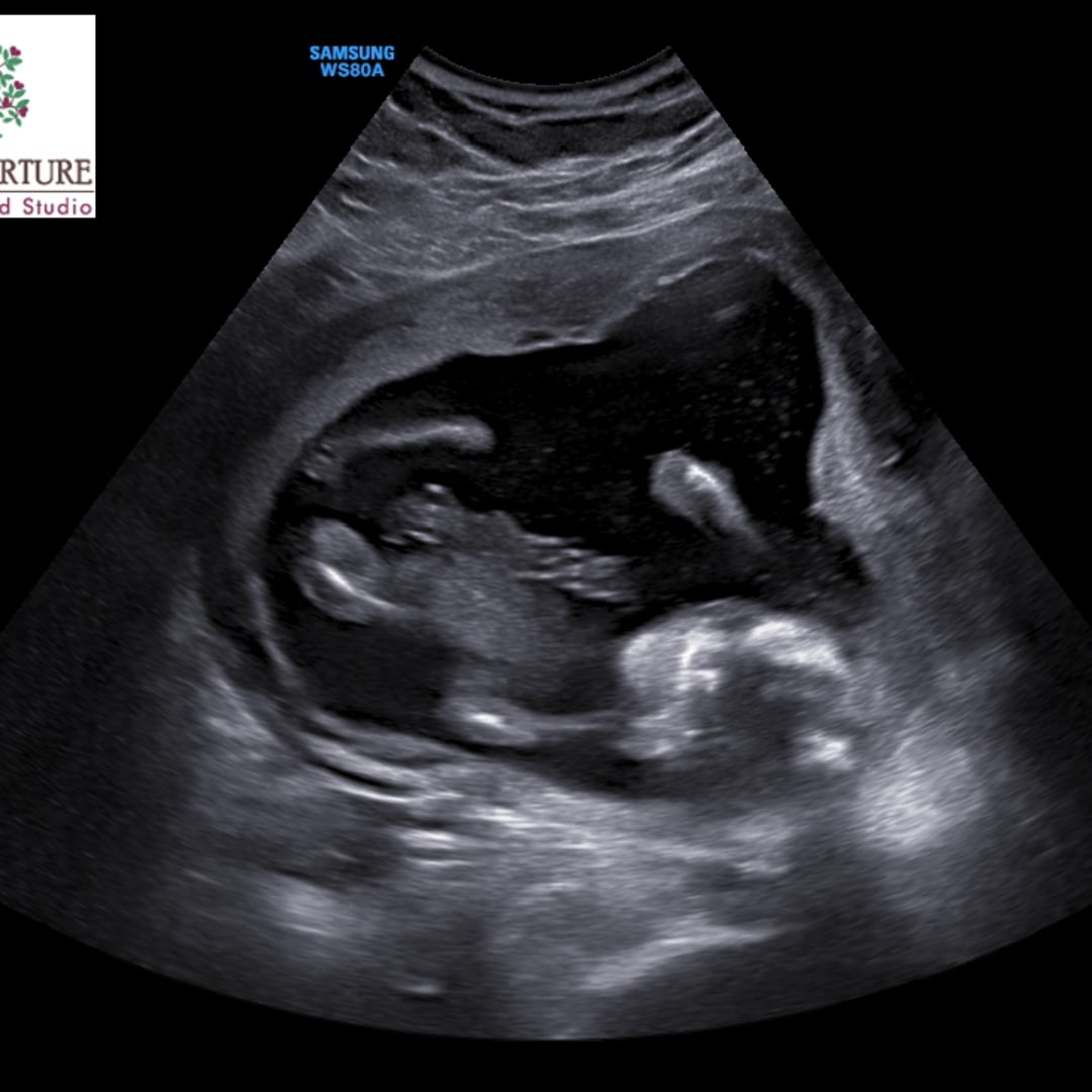 Photo shared by GINA for their Babylist baby registry.