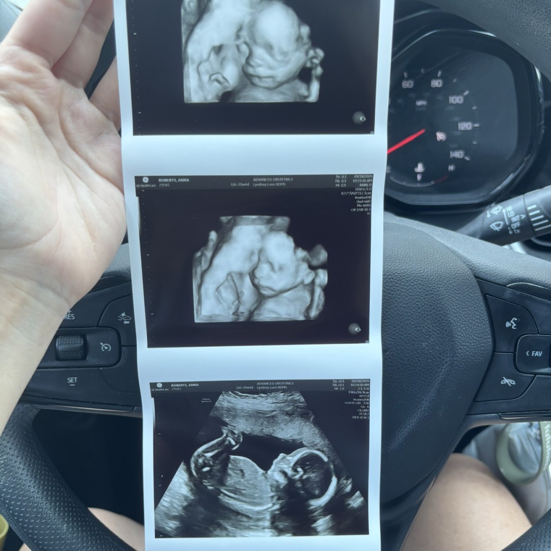 Photo shared by Caitlyn for their Babylist baby registry.
