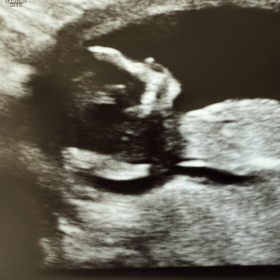 Photo shared by Krista for their Babylist baby registry.
