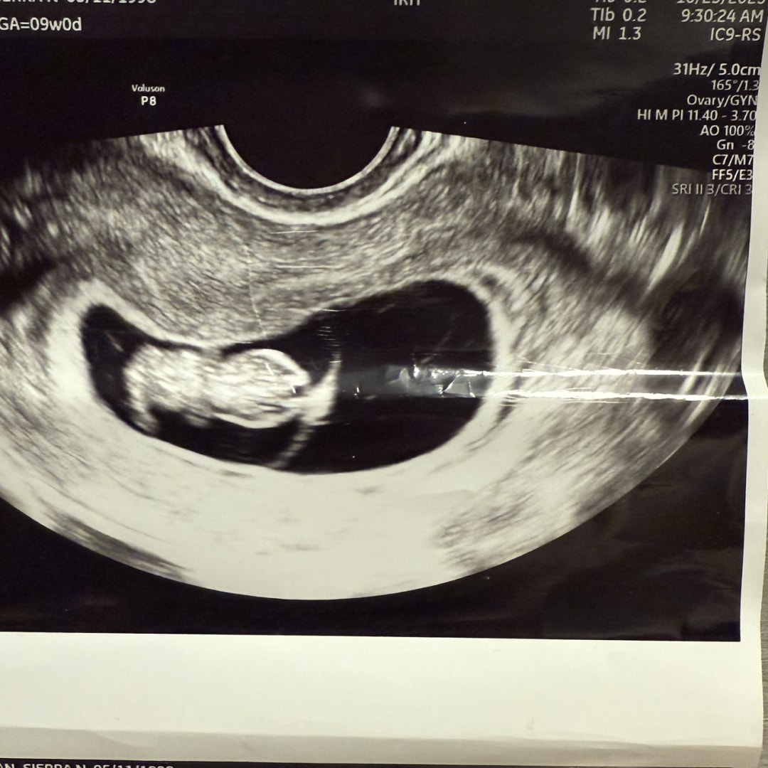 Photo shared by Sierra for their Babylist baby registry.