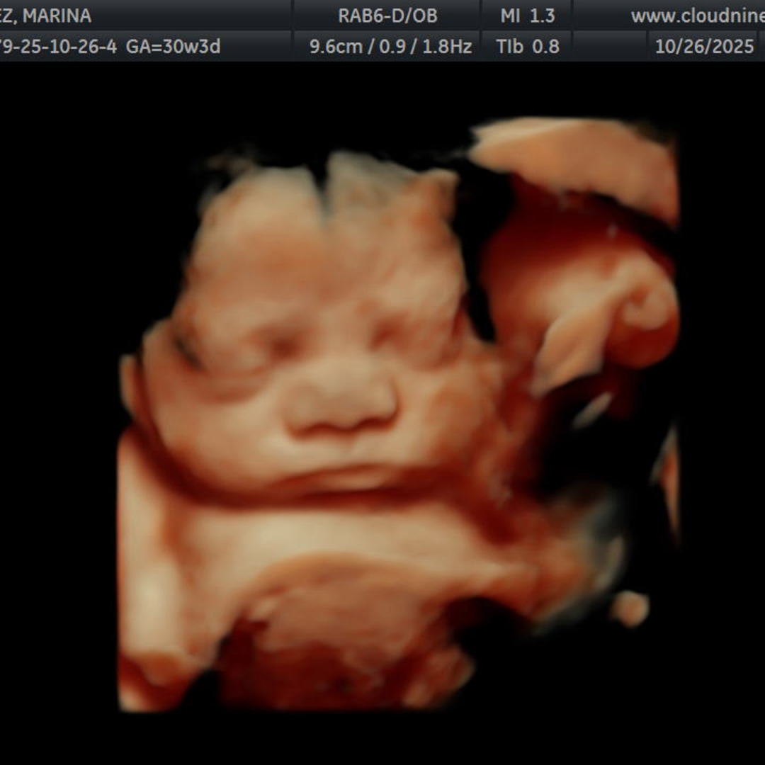 Photo shared by Marina for their Babylist baby registry.