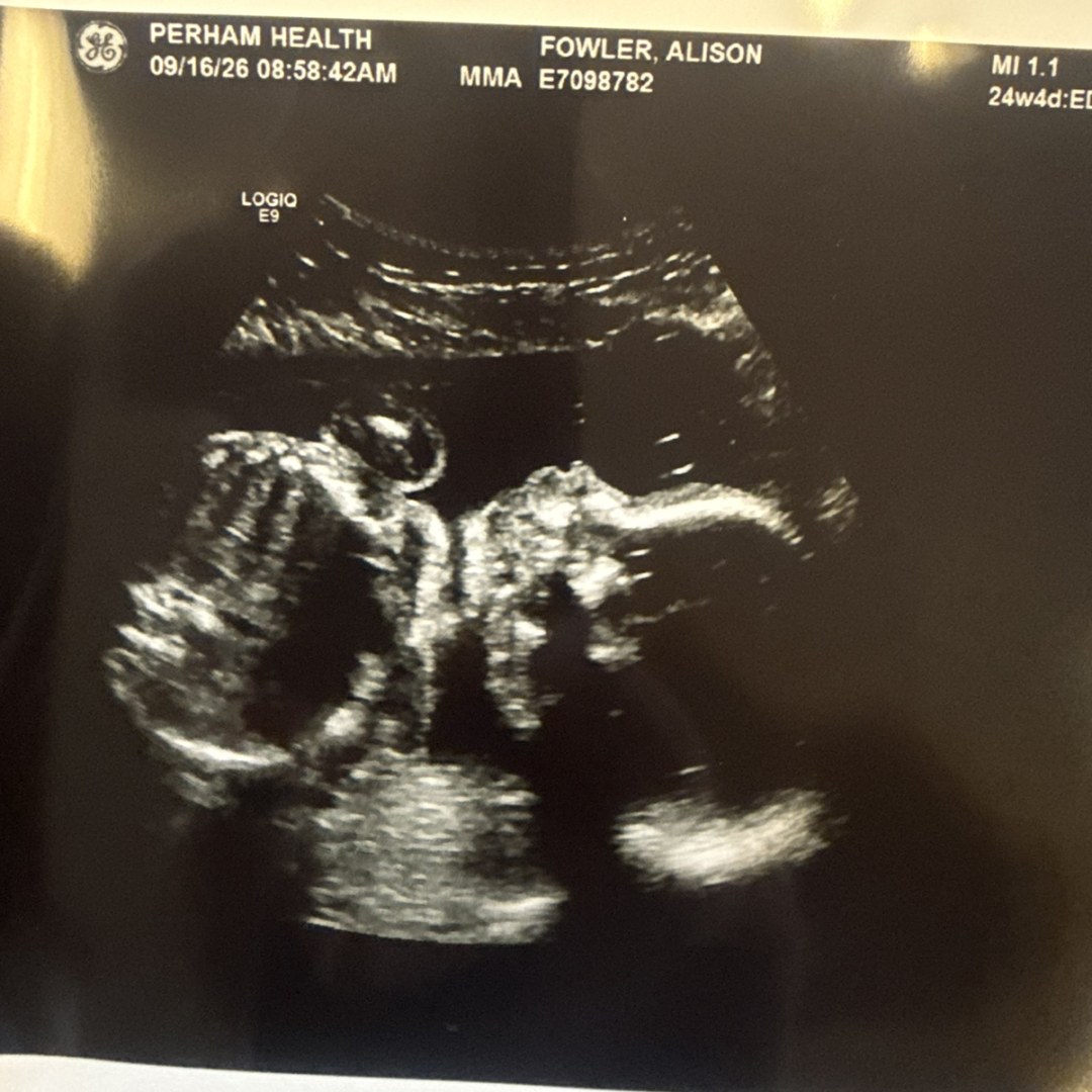 Photo shared by Alison for their Babylist baby registry.