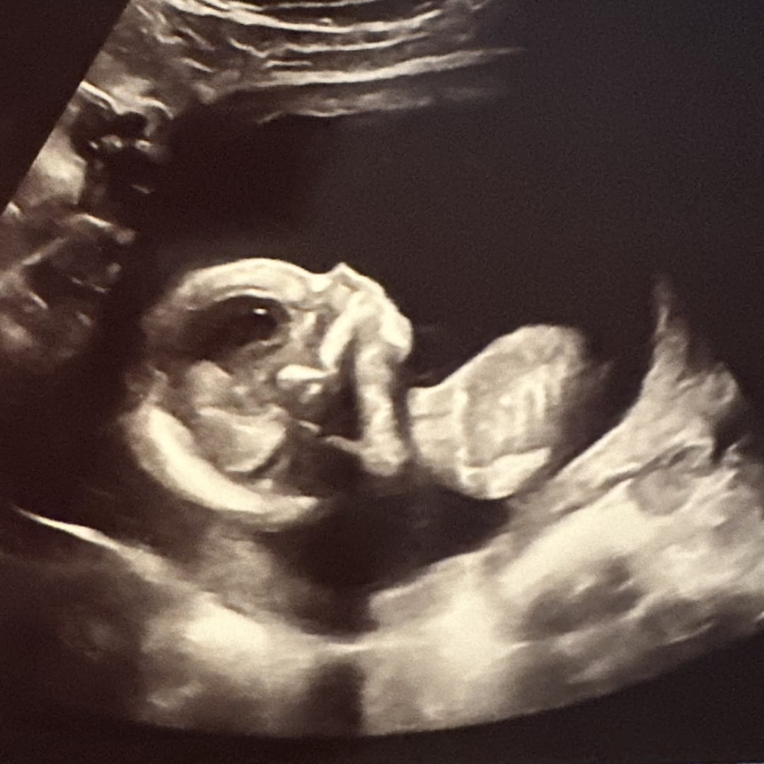 Photo shared by Katie for their Babylist baby registry.