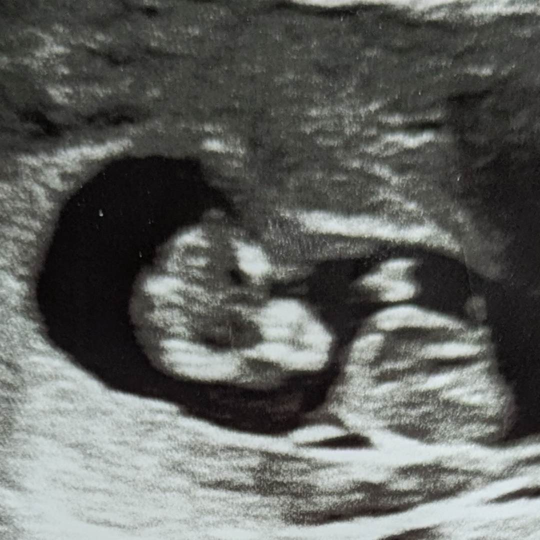 Photo shared by Brigitte for their Babylist baby registry.