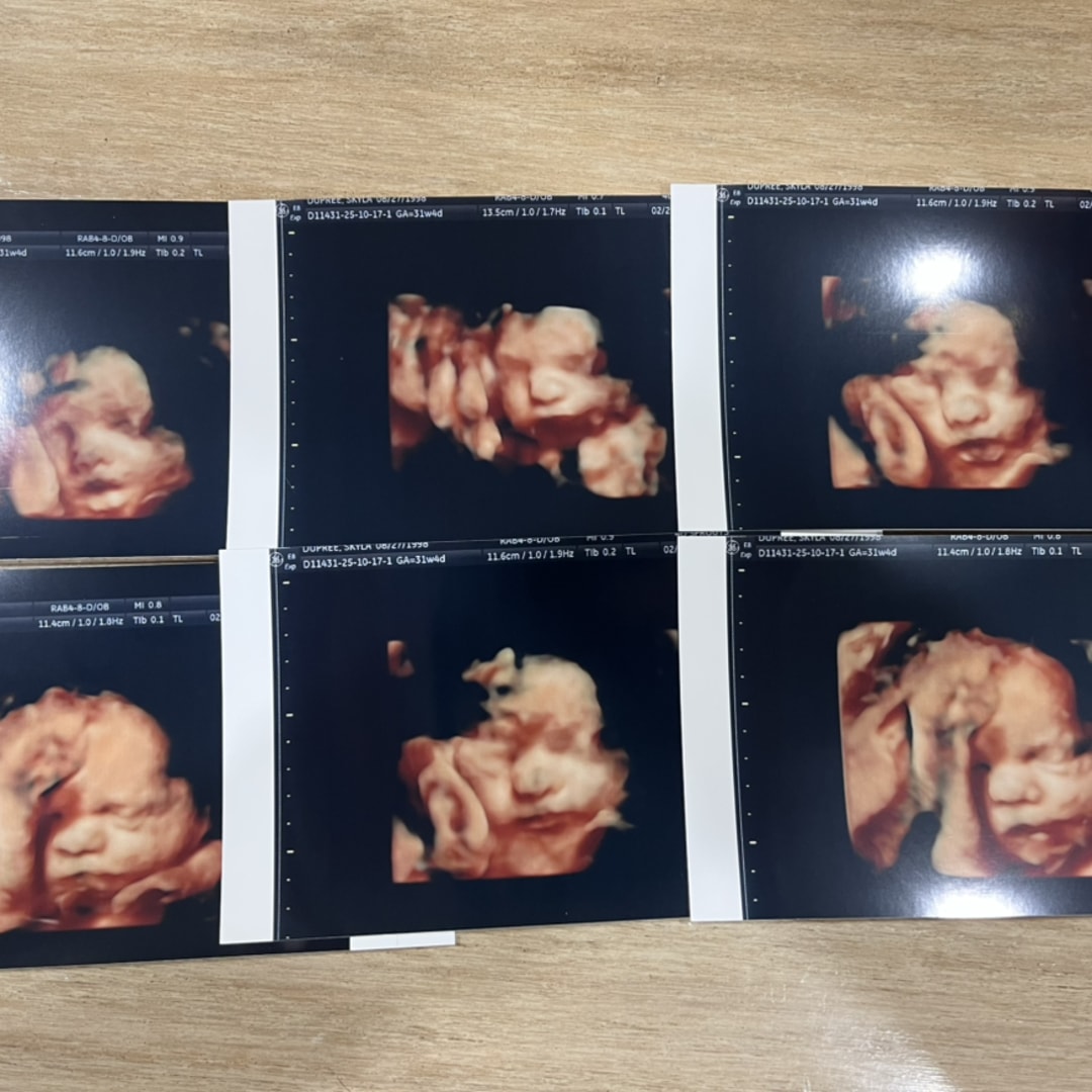 Photo shared by Skyla for their Babylist baby registry.