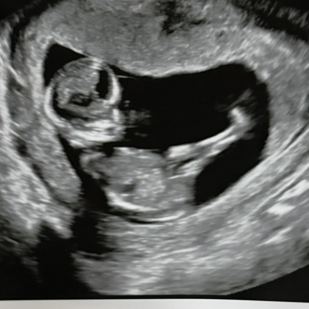 Photo shared by Sarah for their Babylist baby registry.