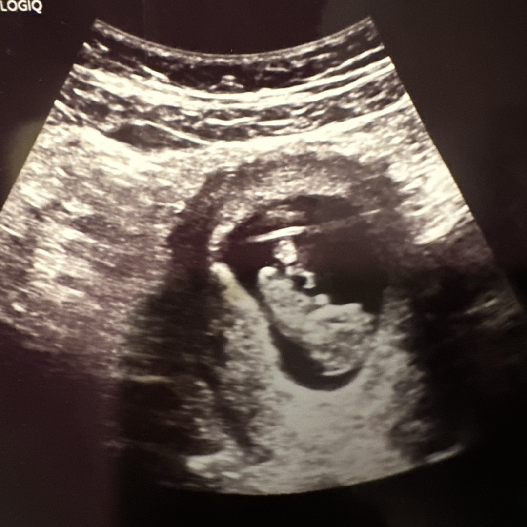Photo shared by Dahlia for their Babylist baby registry.