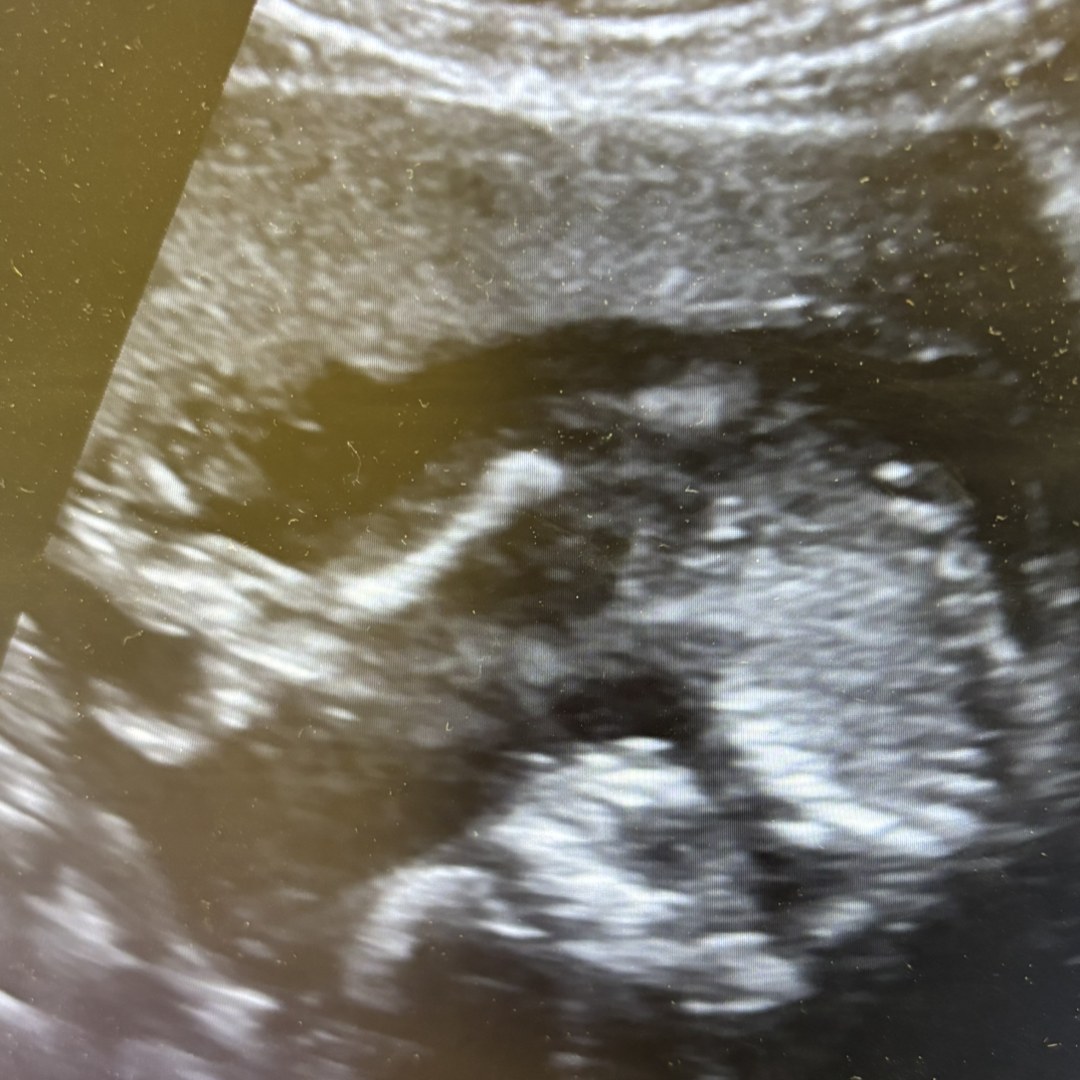 Photo shared by Danielle for their Babylist baby registry.