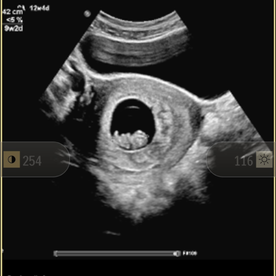 Photo shared by Allison for their Babylist baby registry.