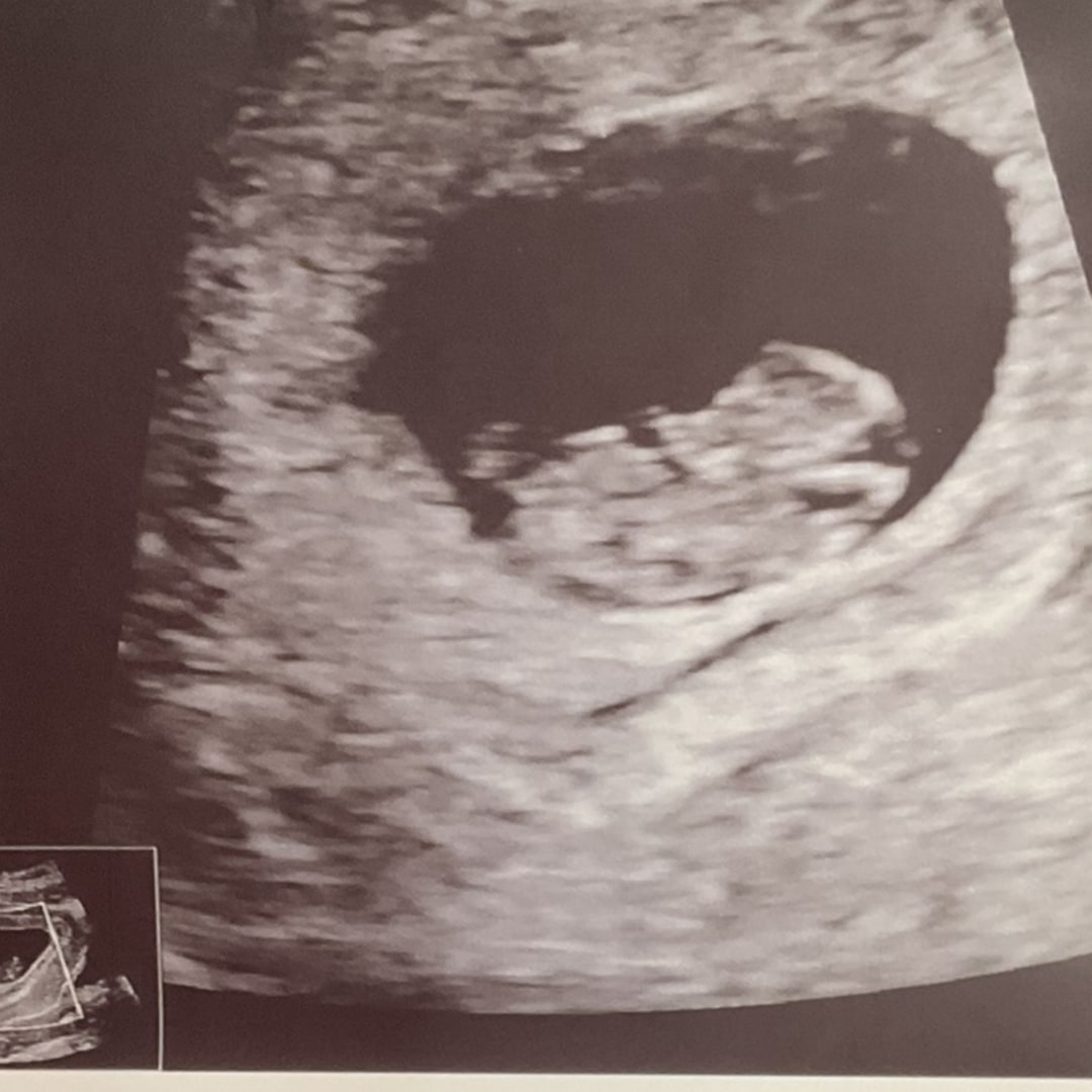Photo shared by Shakiah for their Babylist baby registry.
