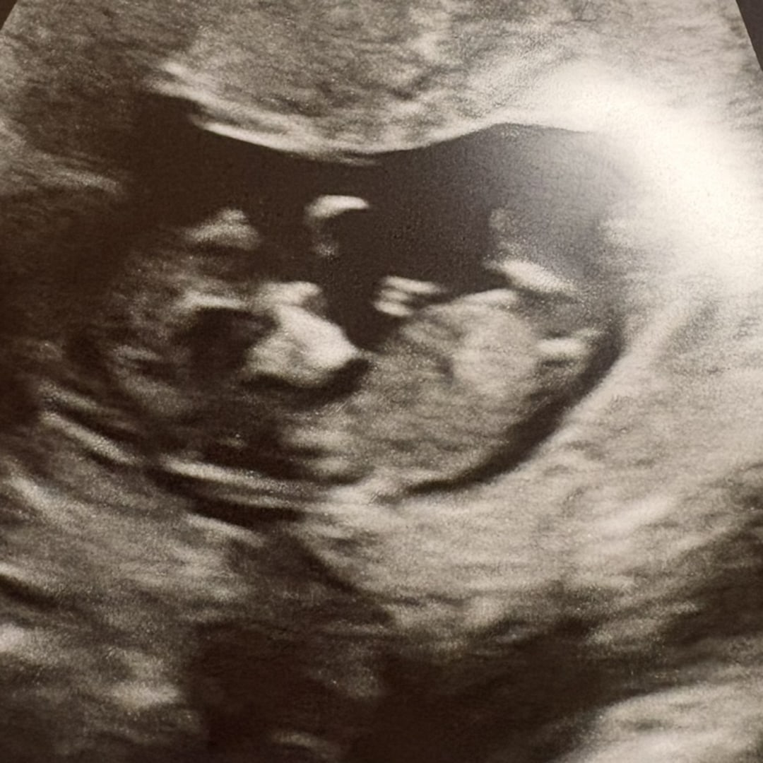 Photo shared by Savannah for their Babylist baby registry.