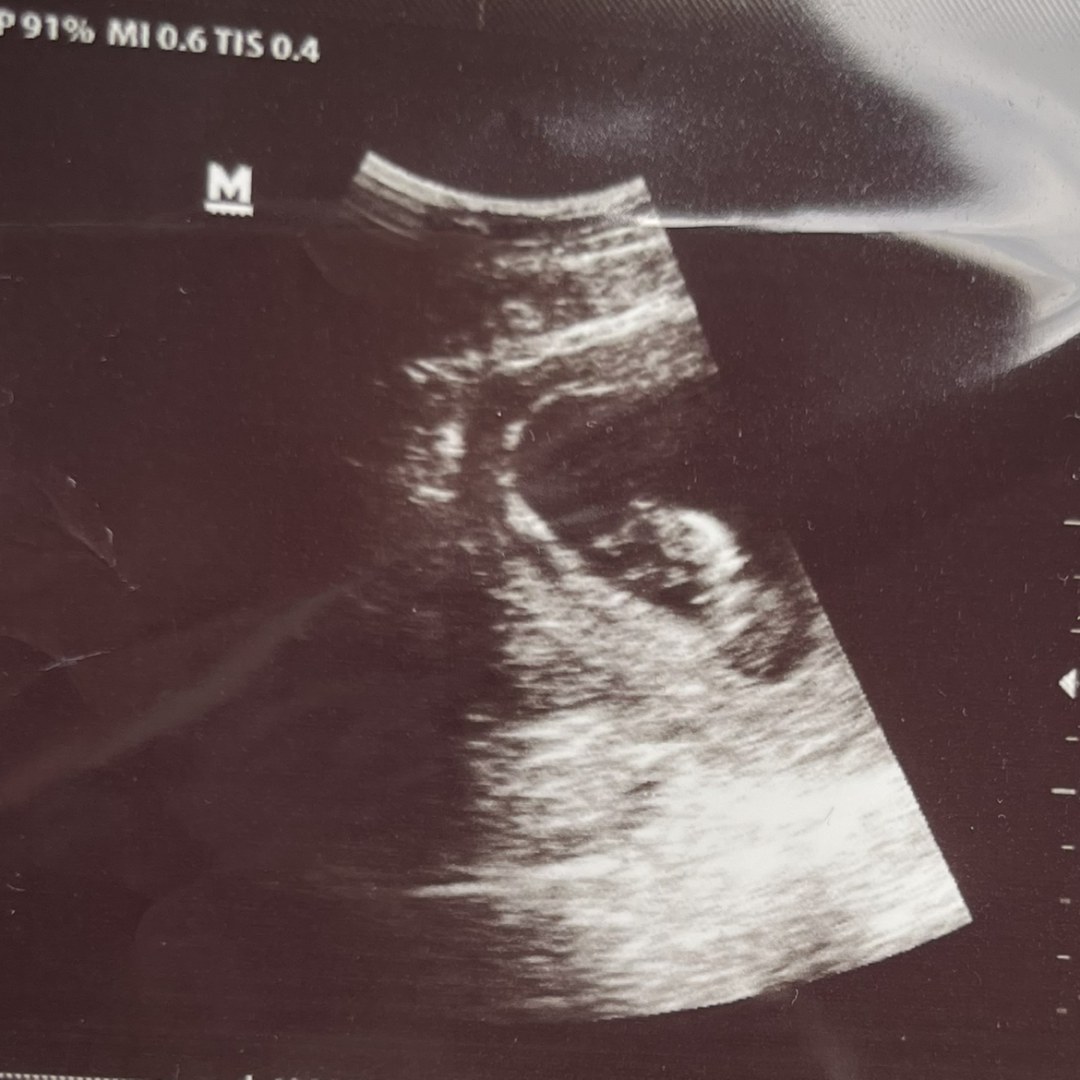 Photo shared by Imani for their Babylist baby registry.