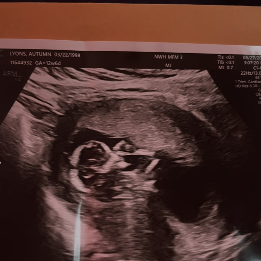 Photo shared by Autumn for their Babylist baby registry.
