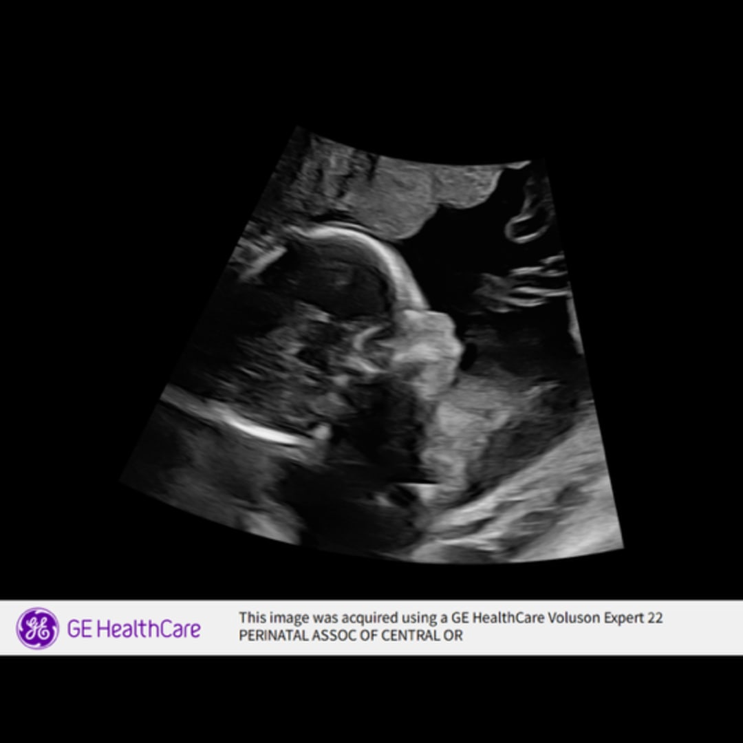 Photo shared by Sage for their Babylist baby registry.