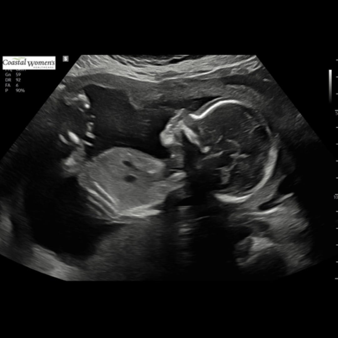 Photo shared by Sara for their Babylist baby registry.