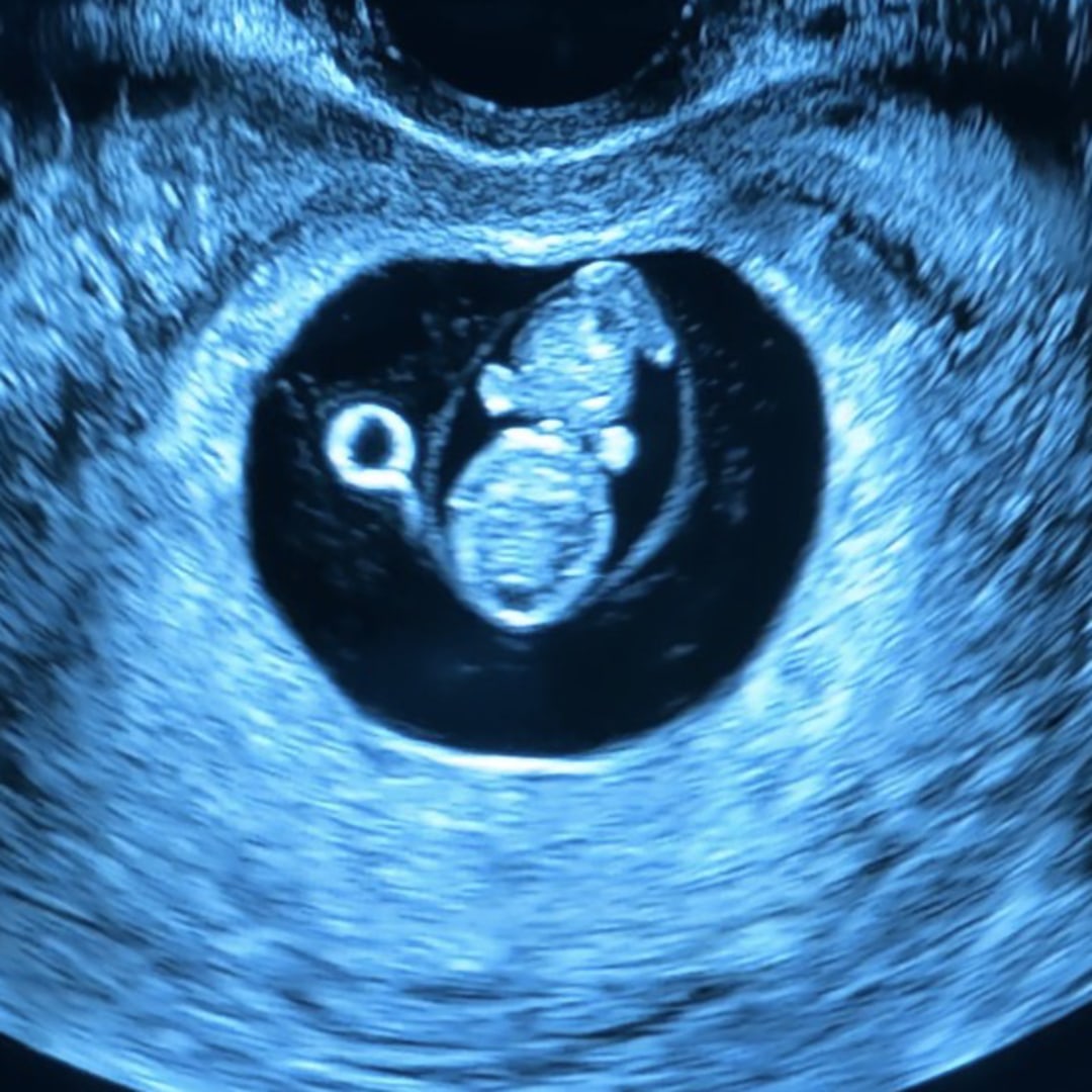 Photo shared by Camille for their Babylist baby registry.