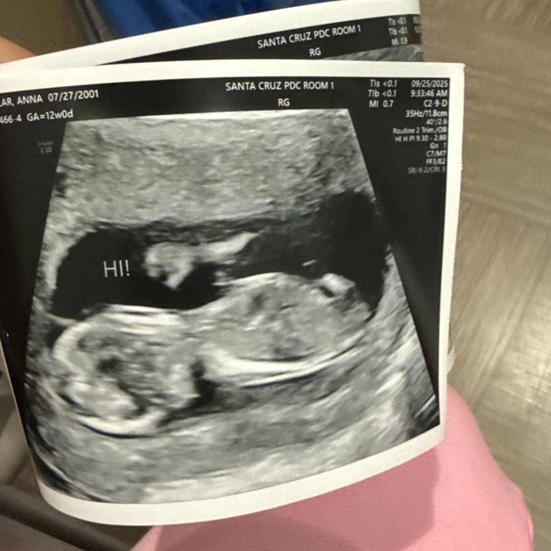 Photo shared by Anna for their Babylist baby registry.