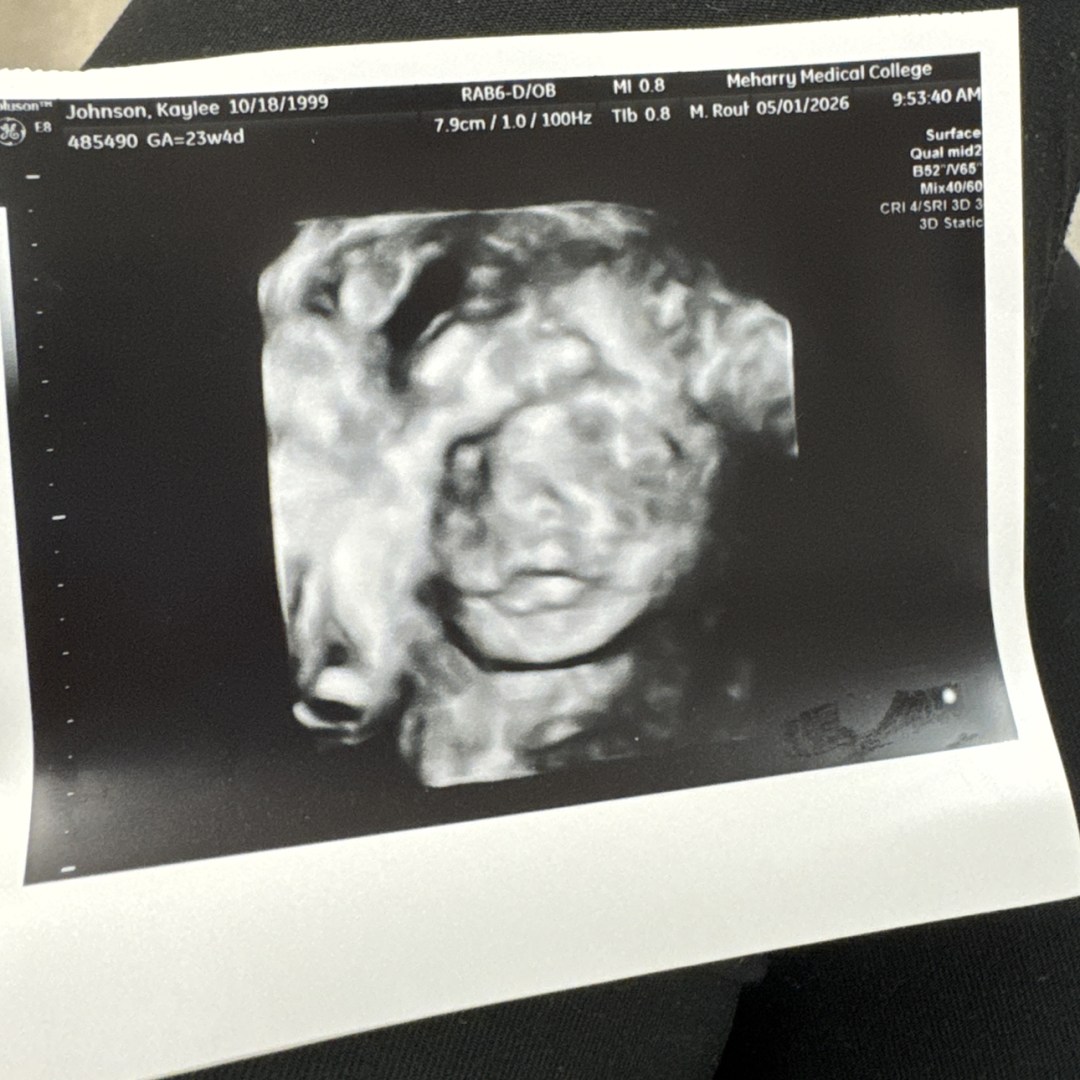 Photo shared by Kaylee for their Babylist baby registry.