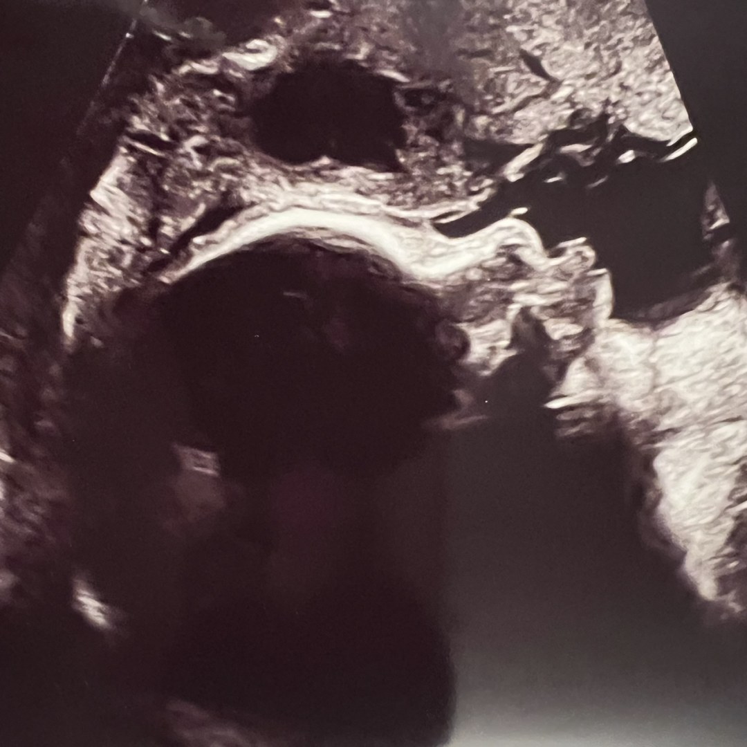 Photo shared by Nadia & Cesar for their Babylist baby registry.