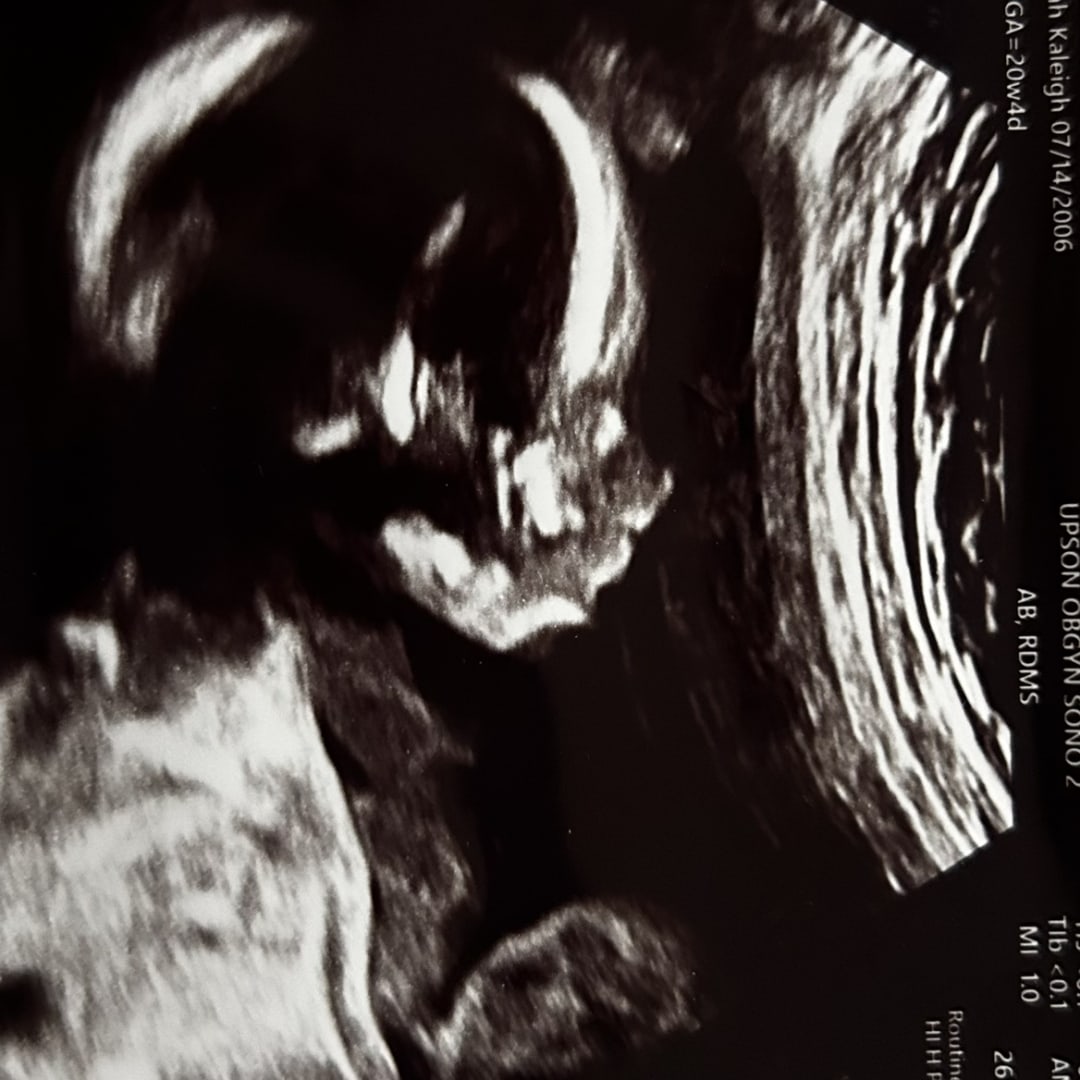 Photo shared by Hannah for their Babylist baby registry.