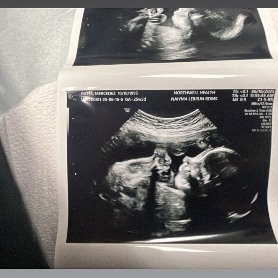 Photo shared by Mercedez for their Babylist baby registry.