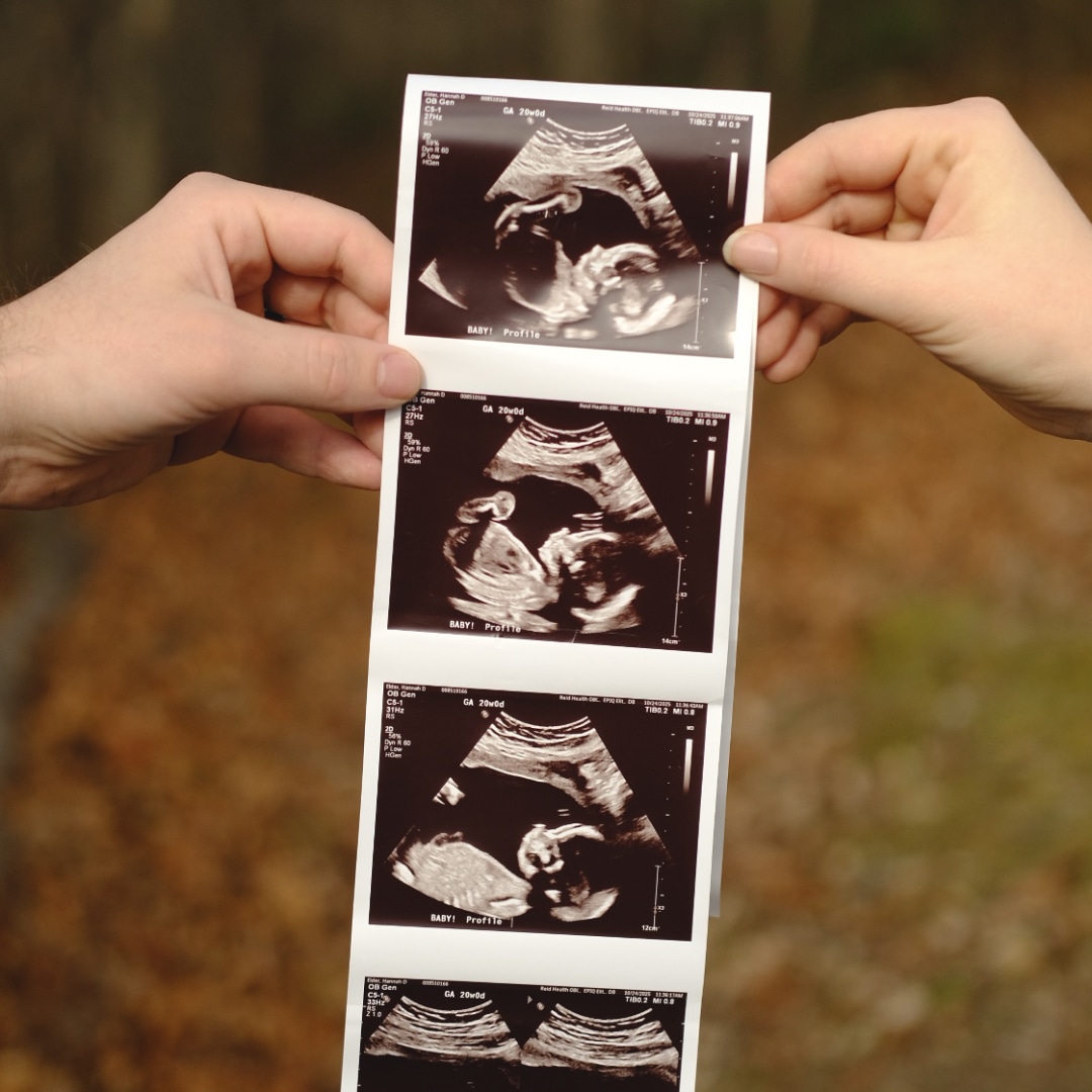 Photo shared by Hannah for their Babylist baby registry.