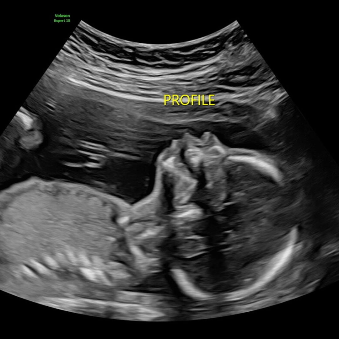 Photo shared by Laura for their Babylist baby registry.