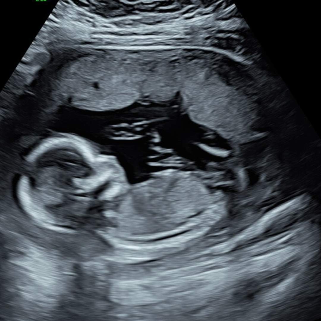 Photo shared by Antonia for their Babylist baby registry.