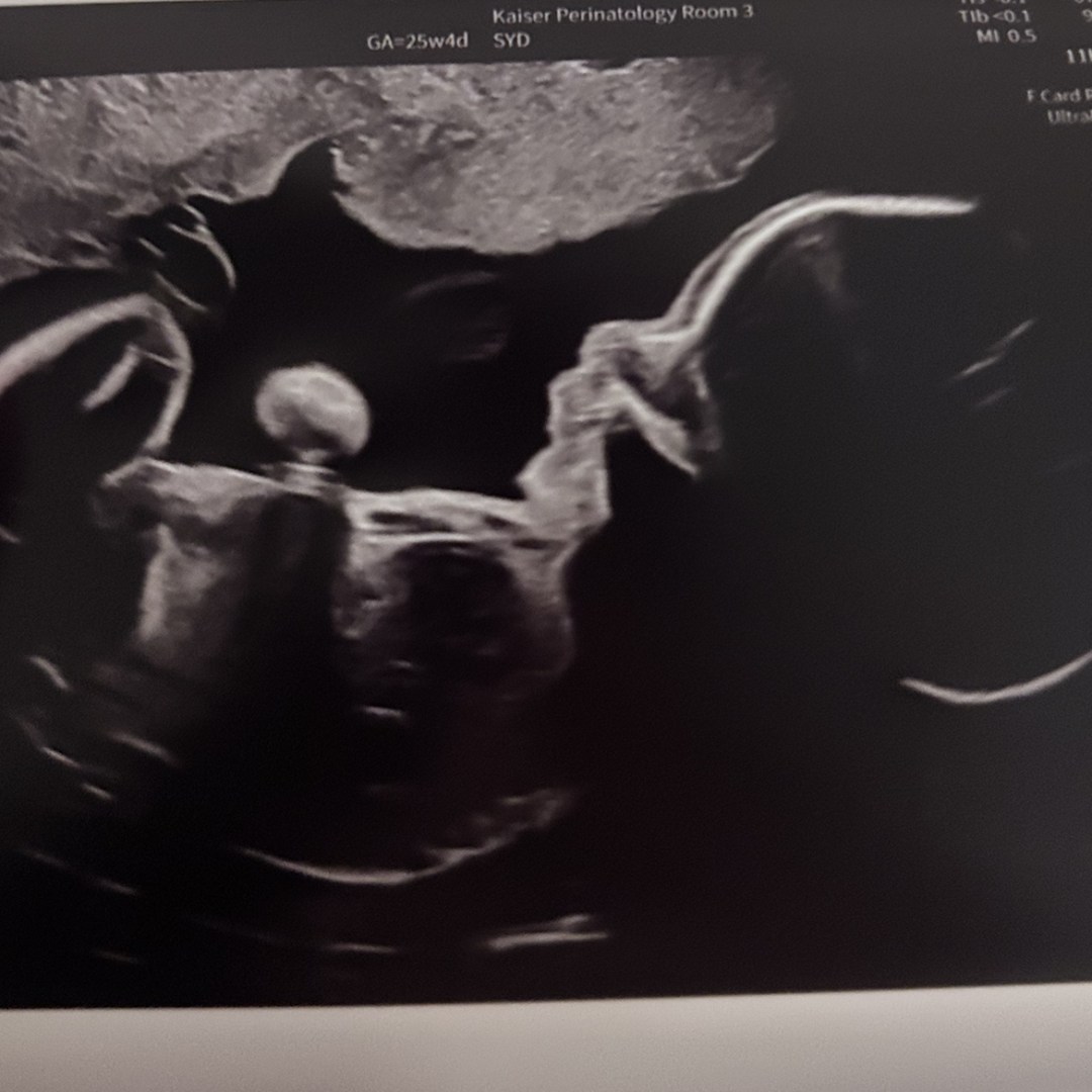 Photo shared by Kemberly for their Babylist baby registry.