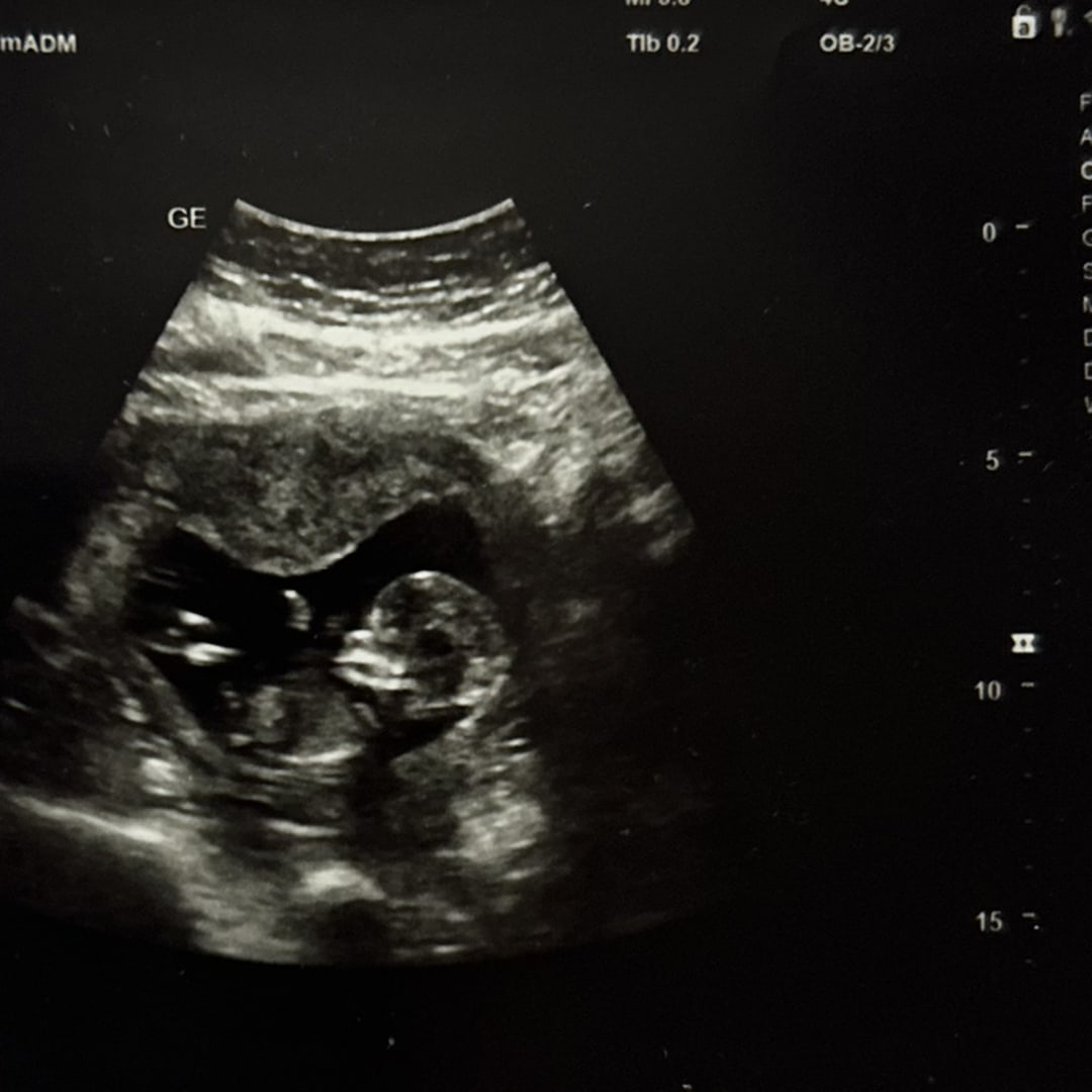 Photo shared by Kristina for their Babylist baby registry.