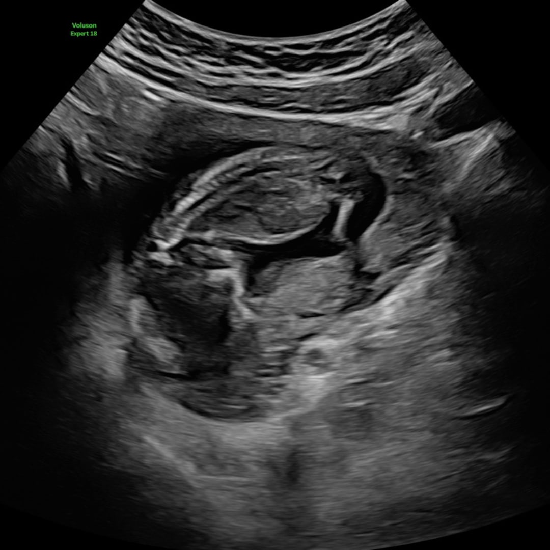 Photo shared by Chloe for their Babylist baby registry.