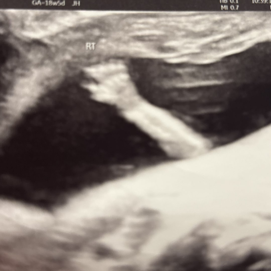 Photo shared by Jennifer for their Babylist baby registry.