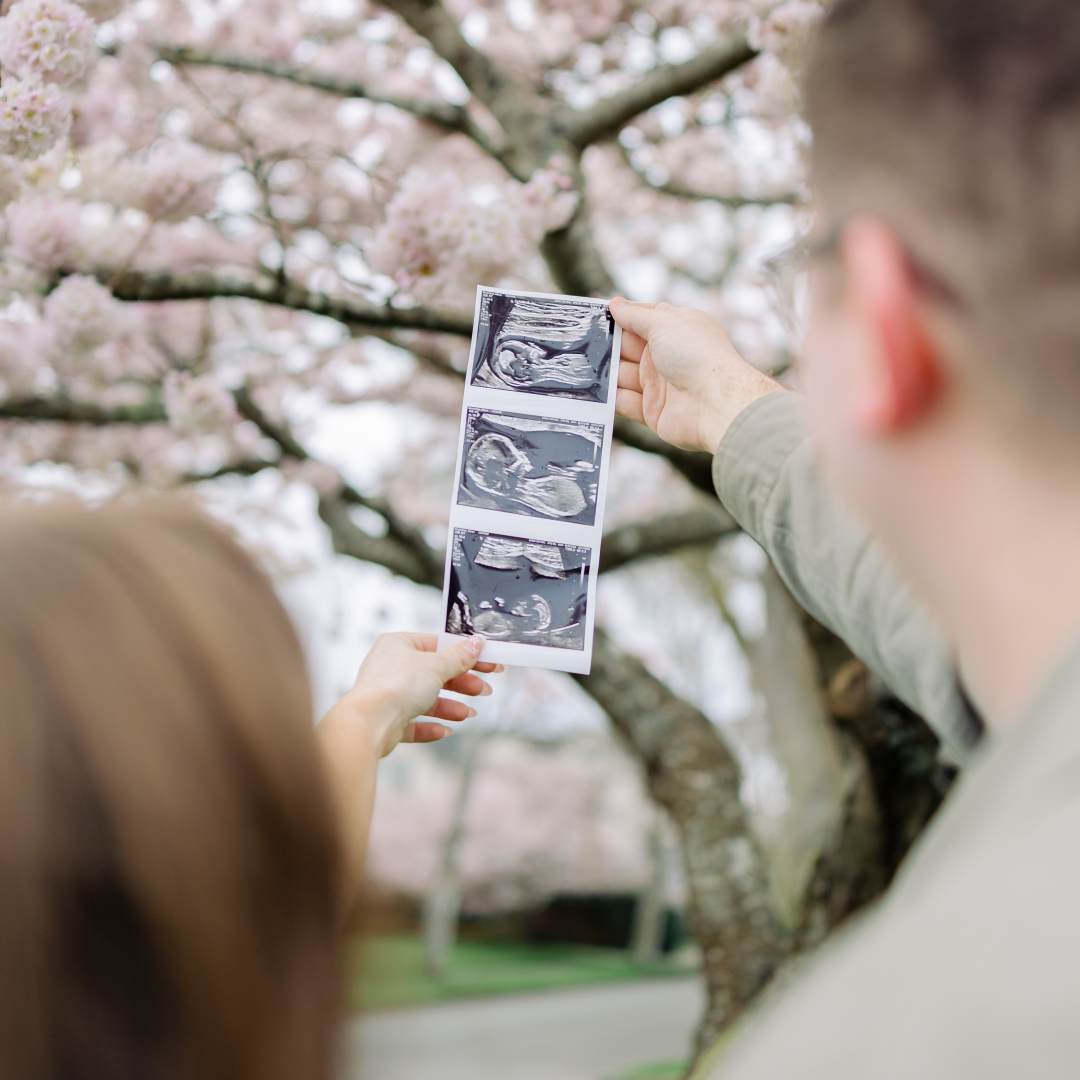 Photo shared by Allison for their Babylist baby registry.