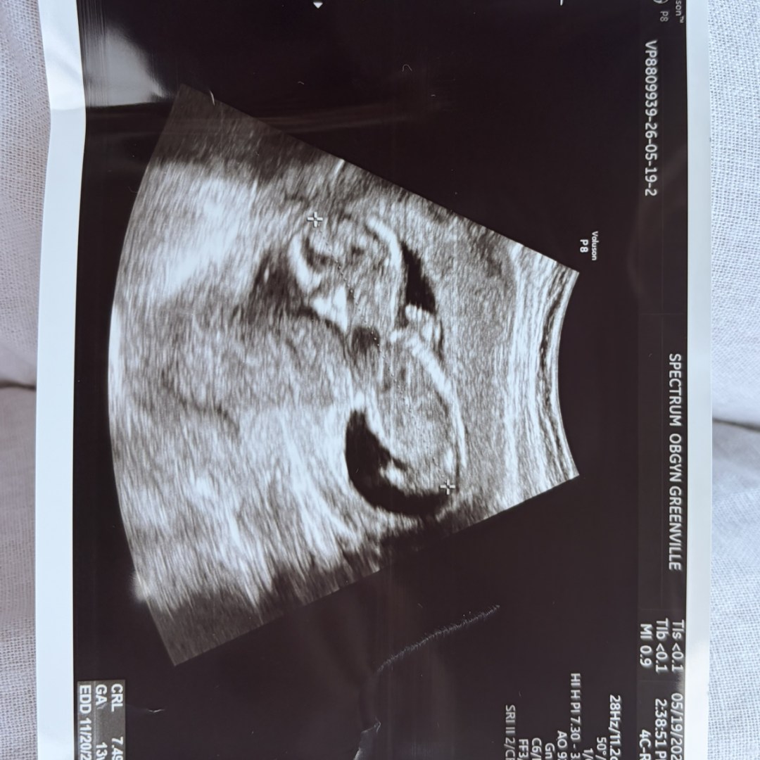 Photo shared by Taylor for their Babylist baby registry.
