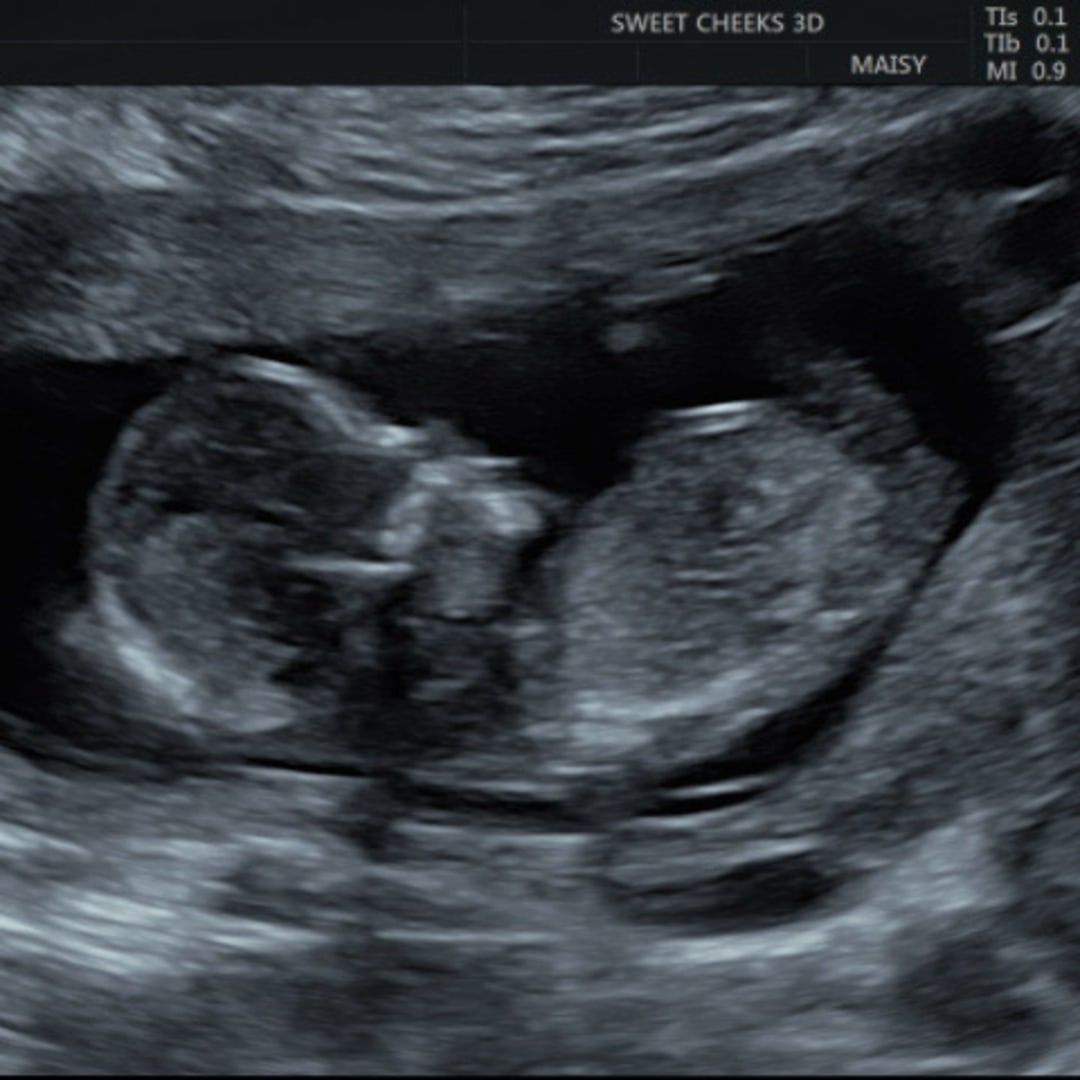 Photo shared by Kaylee for their Babylist baby registry.