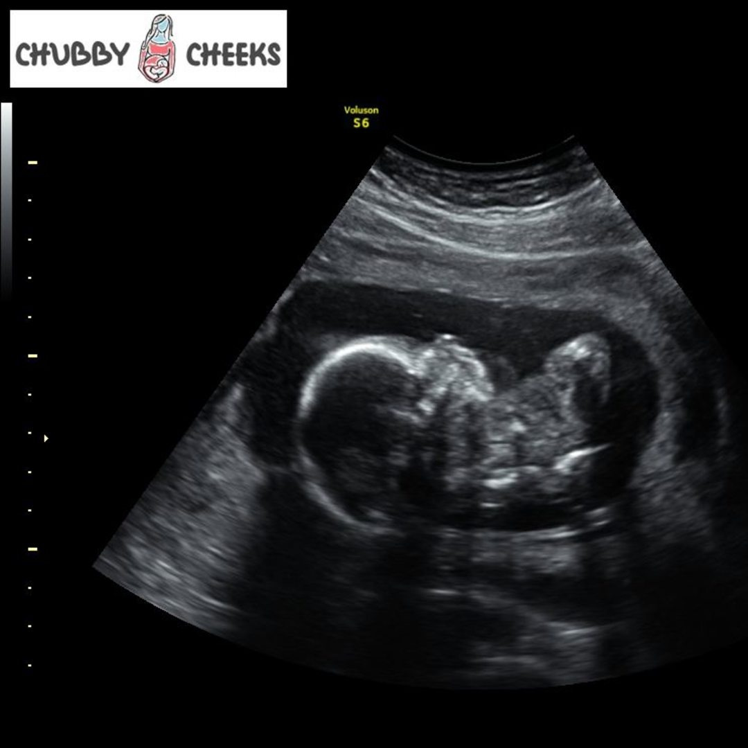 Photo shared by Jillique for their Babylist baby registry.