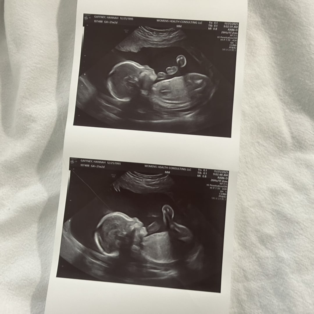 Photo shared by Hannah for their Babylist baby registry.