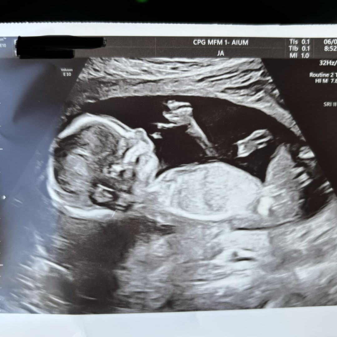 Photo shared by Ariah for their Babylist baby registry.