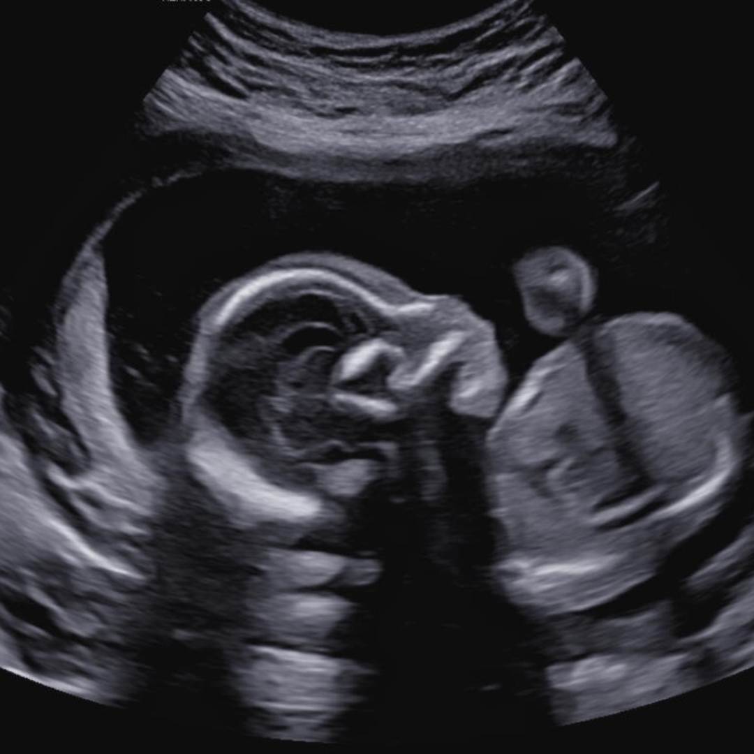 Photo shared by Bekah for their Babylist baby registry.