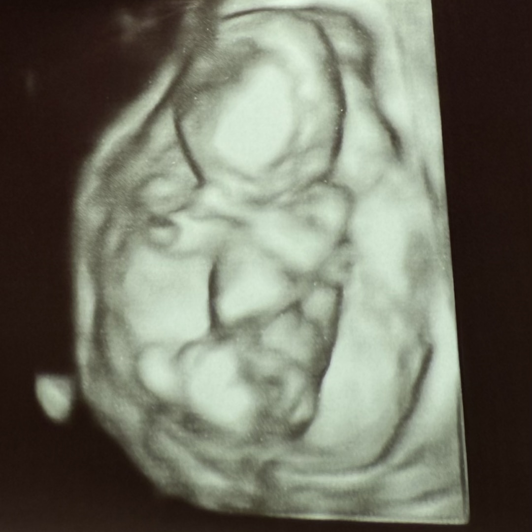 Photo shared by Haley for their Babylist baby registry.
