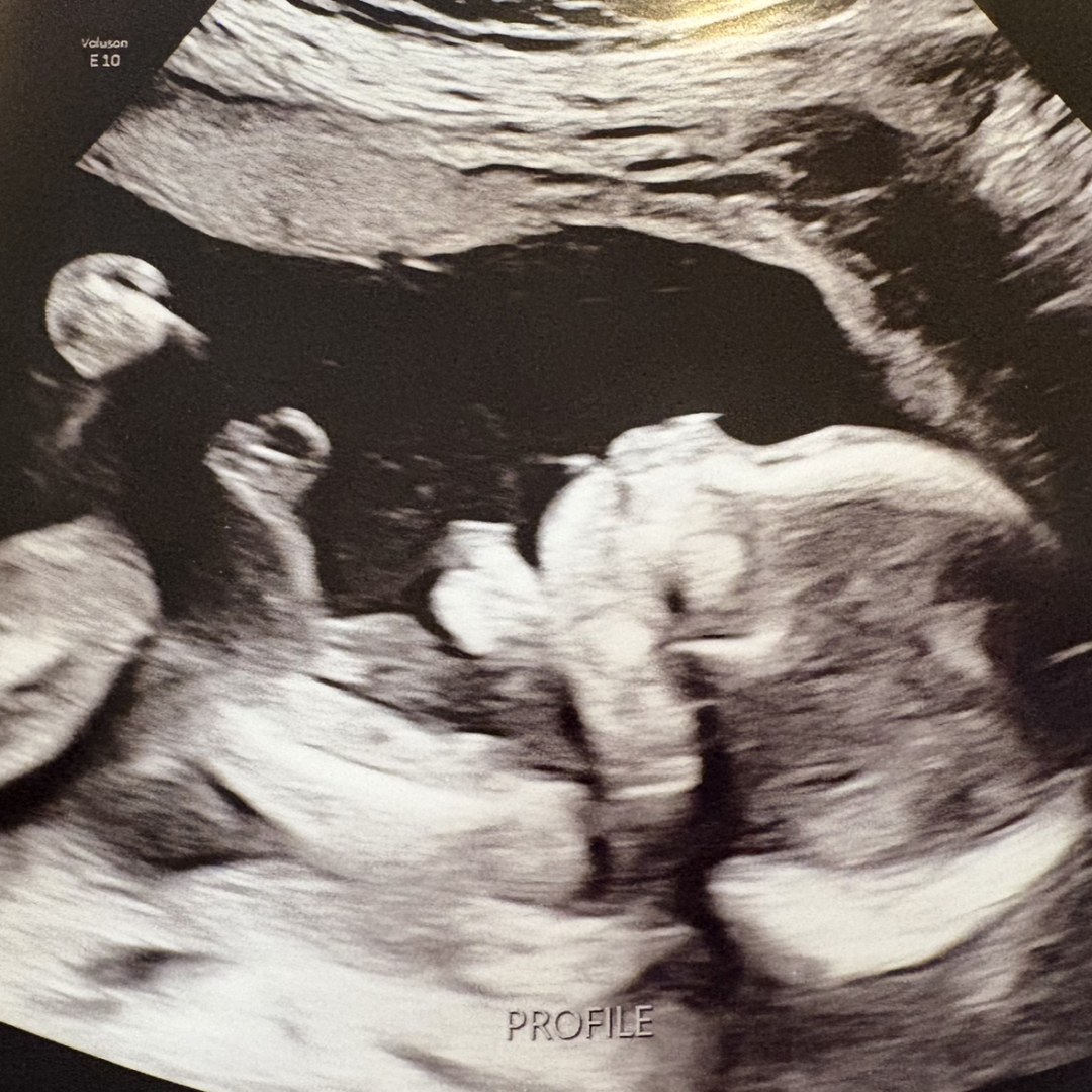Photo shared by Ryann for their Babylist baby registry.