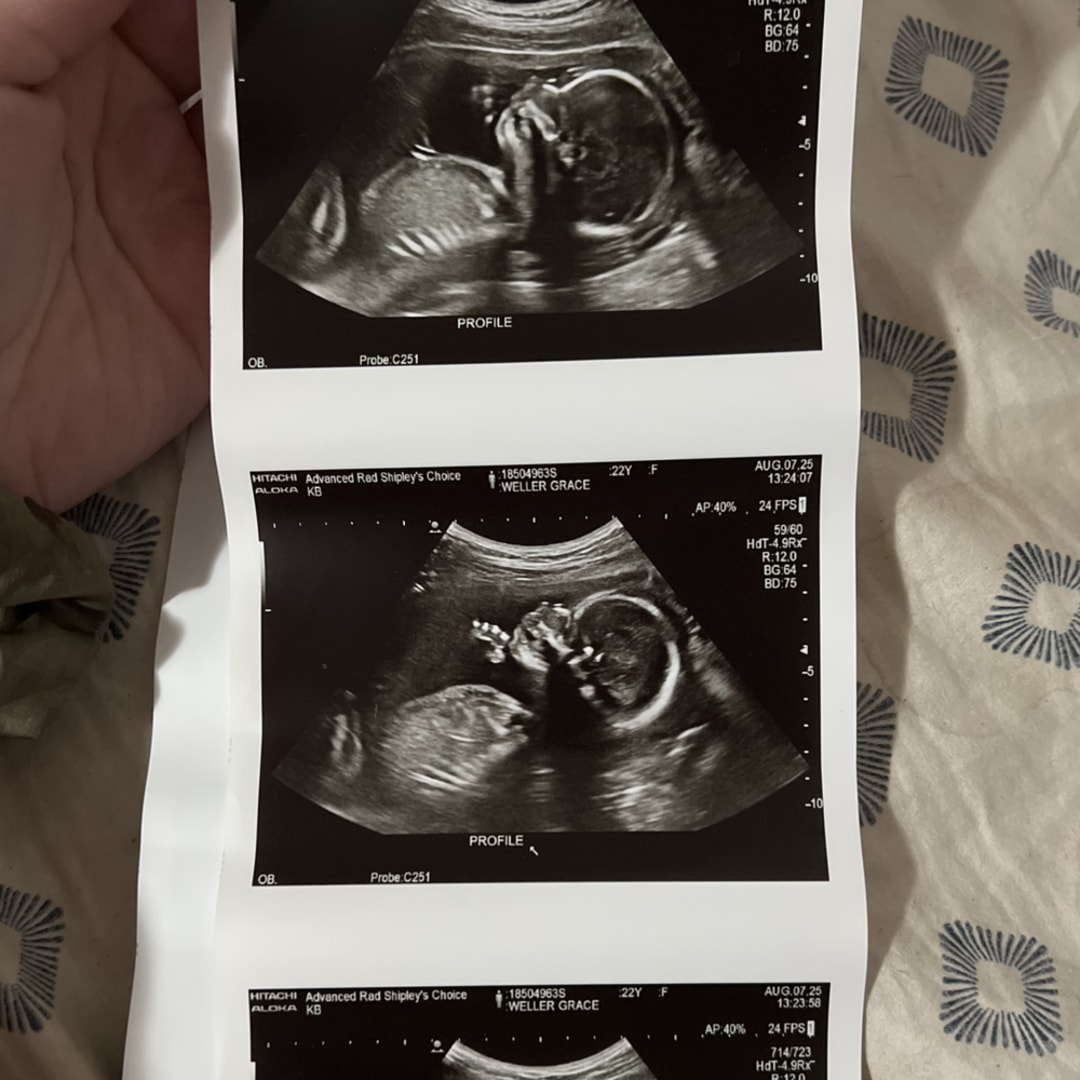 Photo shared by Grace for their Babylist baby registry.