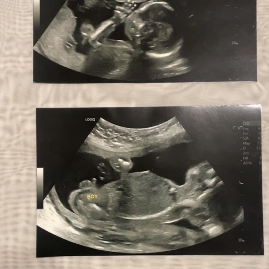 Photo shared by Lily for their Babylist baby registry.