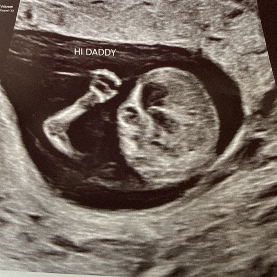 Photo shared by Melanie for their Babylist baby registry.