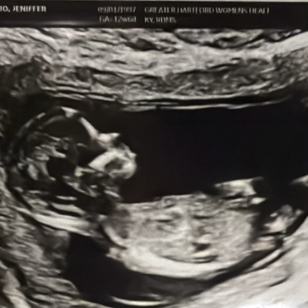 Photo shared by Rhianna for their Babylist baby registry.