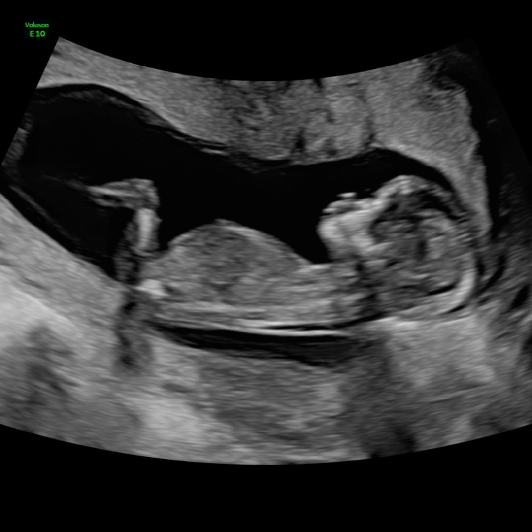 Photo shared by Cheldany for their Babylist baby registry.